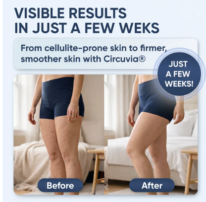 CIRCUVIA® 4 w 1 – Terapia Światłem, Redukcja Cellulitu, Poprawa Krążenia